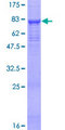 SPAM1 / PH20 Protein - 12.5% SDS-PAGE of human SPAM1 stained with Coomassie Blue