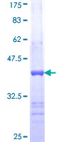 SPAM1 / PH20 Protein - 12.5% SDS-PAGE Stained with Coomassie Blue.
