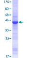 SPANXA1 Protein - 12.5% SDS-PAGE of human SPANXA1 stained with Coomassie Blue