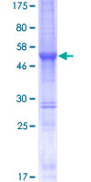 SPANXN2 Protein - 12.5% SDS-PAGE of human SPANXN2 stained with Coomassie Blue