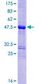 SPANXN3 Protein - 12.5% SDS-PAGE of human SPANX-N3 stained with Coomassie Blue