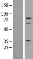SPARCL1 / Hevin Protein - Western validation with an anti-DDK antibody * L: Control HEK293 lysate R: Over-expression lysate