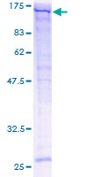 SPARCL1 / Hevin Protein - 12.5% SDS-PAGE of human SPARCL1 stained with Coomassie Blue