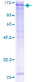 SPARCL1 / Hevin Protein - 12.5% SDS-PAGE of human SPARCL1 stained with Coomassie Blue