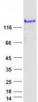 SPARCL1 / Hevin Protein - Purified recombinant protein SPARCL1 was analyzed by SDS-PAGE gel and Coomassie Blue Staining
