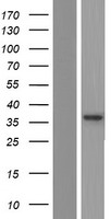 Spastic / GLRB Protein - Western validation with an anti-DDK antibody * L: Control HEK293 lysate R: Over-expression lysate
