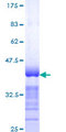 Spastin Protein - 12.5% SDS-PAGE Stained with Coomassie Blue.