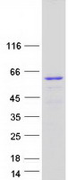 Spastin Protein - Purified recombinant protein SPAST was analyzed by SDS-PAGE gel and Coomassie Blue Staining