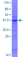 SPATA12 Protein - 12.5% SDS-PAGE of human SPATA12 stained with Coomassie Blue