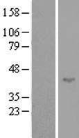 SPATA17 / IQCH Protein - Western validation with an anti-DDK antibody * L: Control HEK293 lysate R: Over-expression lysate