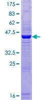 SPATA19 Protein - 12.5% SDS-PAGE of human SPATA19 stained with Coomassie Blue
