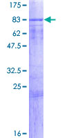 SPATA2 Protein - 12.5% SDS-PAGE of human SPATA2 stained with Coomassie Blue