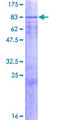 SPATA2 Protein - 12.5% SDS-PAGE of human SPATA2 stained with Coomassie Blue