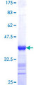 SPATA2 Protein - 12.5% SDS-PAGE Stained with Coomassie Blue.