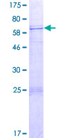 SPATA22 Protein - 12.5% SDS-PAGE of human SPATA22 stained with Coomassie Blue