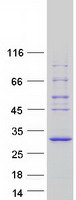 SPATA25 Protein - Purified recombinant protein SPATA25 was analyzed by SDS-PAGE gel and Coomassie Blue Staining