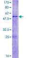 SPATA3 / ASARG1 Protein - 12.5% SDS-PAGE of human SPATA3 stained with Coomassie Blue