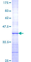 SPATA4 Protein - 12.5% SDS-PAGE Stained with Coomassie Blue.