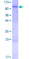 SPATA5 Protein - 12.5% SDS-PAGE of human SPATA5 stained with Coomassie Blue