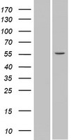 SPATA6 / SRF-1 Protein - Western validation with an anti-DDK antibody * L: Control HEK293 lysate R: Over-expression lysate