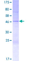SPATS1 Protein - 12.5% SDS-PAGE of human SPATS1 stained with Coomassie Blue