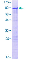 SPATS2L Protein - 12.5% SDS-PAGE of human LOC26010 stained with Coomassie Blue