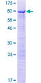 SPATS2L Protein - 12.5% SDS-PAGE of human LOC26010 stained with Coomassie Blue