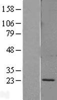 SPC18 / SEC11A Protein - Western validation with an anti-DDK antibody * L: Control HEK293 lysate R: Over-expression lysate