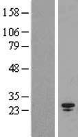 SPC25 Protein - Western validation with an anti-DDK antibody * L: Control HEK293 lysate R: Over-expression lysate