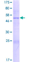 SPC25 Protein - 12.5% SDS-PAGE of human SPC25 stained with Coomassie Blue