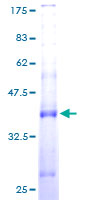 SPCS1 Protein - 12.5% SDS-PAGE of human SPCS1 stained with Coomassie Blue