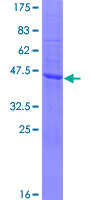 SPCS3 Protein - 12.5% SDS-PAGE of human SPCS3 stained with Coomassie Blue