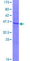 SPCS3 Protein - 12.5% SDS-PAGE of human SPCS3 stained with Coomassie Blue