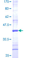 SPCS3 Protein - 12.5% SDS-PAGE Stained with Coomassie Blue.