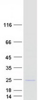 SPCS3 Protein - Purified recombinant protein SPCS3 was analyzed by SDS-PAGE gel and Coomassie Blue Staining