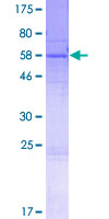SPDYC Protein - 12.5% SDS-PAGE of human SPDYC stained with Coomassie Blue