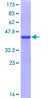 SPECC1 / CYTSB Protein - 12.5% SDS-PAGE Stained with Coomassie Blue.