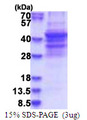 SPECC1 / CYTSB Protein