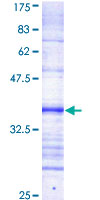 SPEG Protein - 12.5% SDS-PAGE Stained with Coomassie Blue.