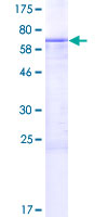SPERT Protein - 12.5% SDS-PAGE of human SPERT stained with Coomassie Blue