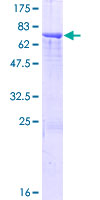 SPESP1 Protein - 12.5% SDS-PAGE of human SPESP1 stained with Coomassie Blue