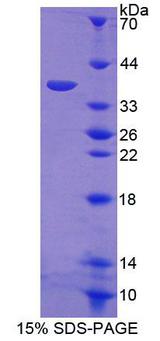 SPFH2 / ERLIN2 Protein - Recombinant Endoplasmic Reticulum Lipid Raft Associated Protein 2 By SDS-PAGE