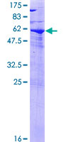 SPG21 / MAST Protein - 12.5% SDS-PAGE of human SPG21 stained with Coomassie Blue