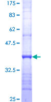 SPG21 / MAST Protein - 12.5% SDS-PAGE Stained with Coomassie Blue.