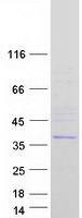 SPG21 / MAST Protein - Purified recombinant protein SPG21 was analyzed by SDS-PAGE gel and Coomassie Blue Staining