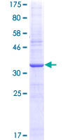 SPHK / SPHK1 Protein - 12.5% SDS-PAGE Stained with Coomassie Blue.