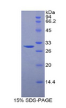 SPHK / SPHK1 Protein - Recombinant Sphingosine Kinase 1 By SDS-PAGE