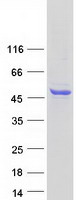SPHK / SPHK1 Protein - Purified recombinant protein SPHK1 was analyzed by SDS-PAGE gel and Coomassie Blue Staining