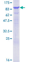 SPHK2 Protein - 12.5% SDS-PAGE of human SPHK2 stained with Coomassie Blue