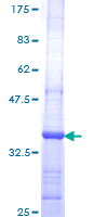 SPHK2 Protein - 12.5% SDS-PAGE Stained with Coomassie Blue.